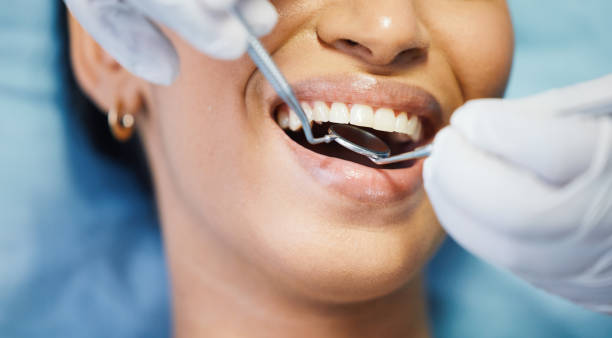 Best Chipped Tooth Repair Near Me  in Lake Hamilton, FL