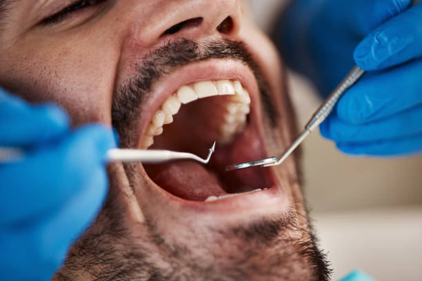 Best Urgent Tooth Repair  in Lake Hamilton, FL